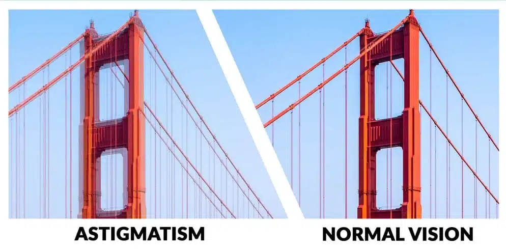 Astigmatism Monterey CA